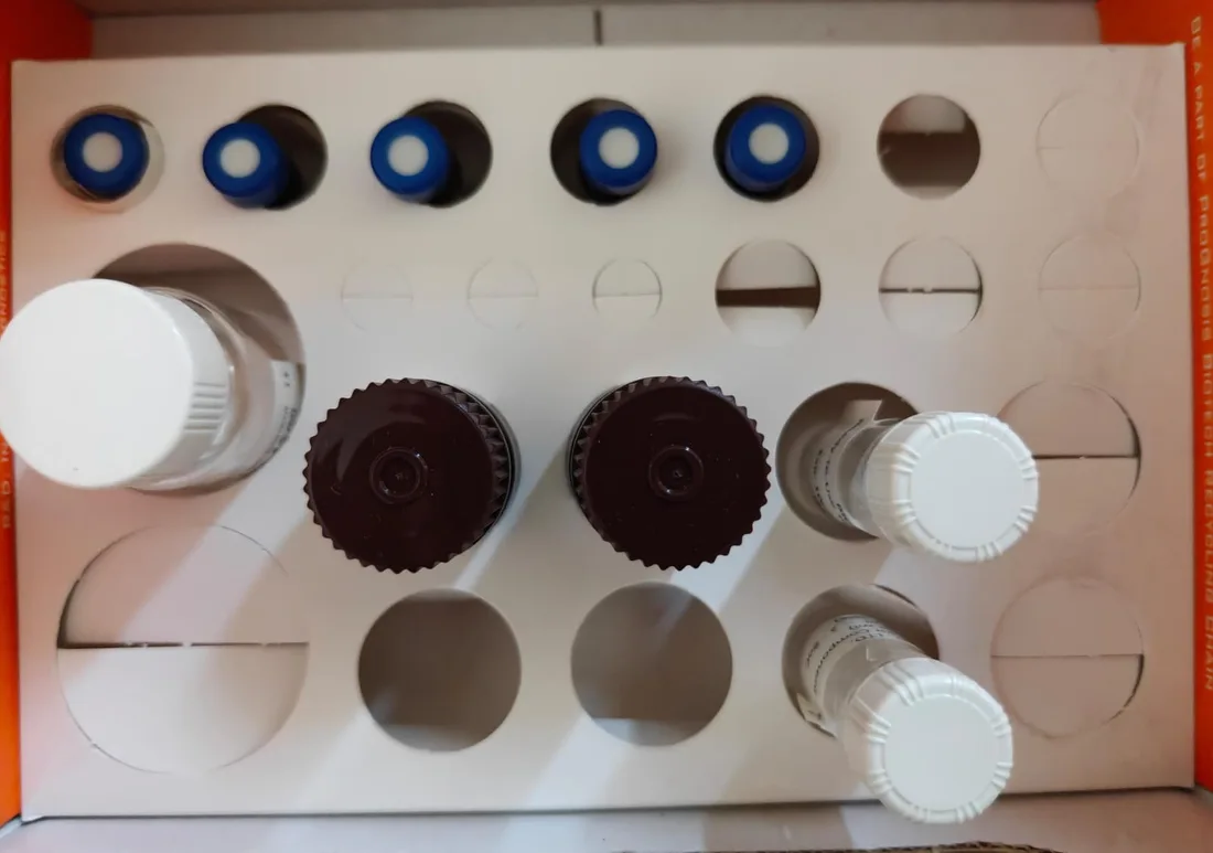 Overhead photograph of bottles and blue-capped vials held in the kit tray